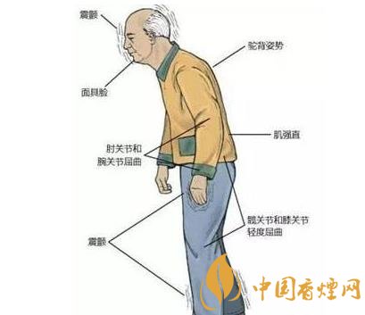 戒烟身体会出现什么反应 戒烟后身体出现不适的情况