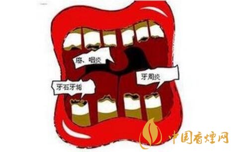 吸烟的危害：吸烟会导致牙周病的发生和加重牙周病的病情