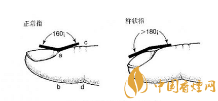 老烟民如果出现这3种症状可能是肺癌！